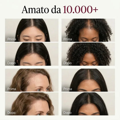 Il Segreto Coreano per Capelli più Folti
